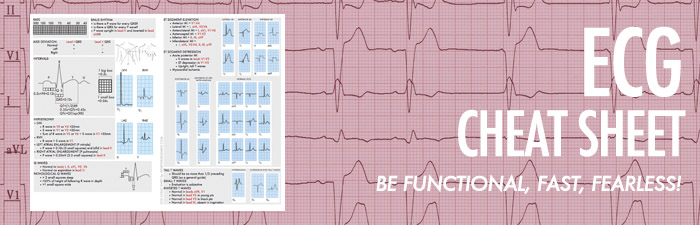 How to Read Ecg for Dummies  