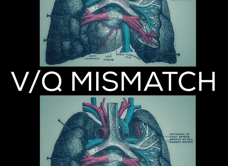 Ventilation/Perfusion (V/Q) Ratio and Mismatch