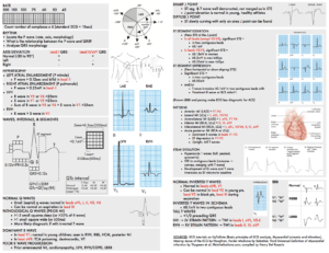 ecg for dummies cheat sheet